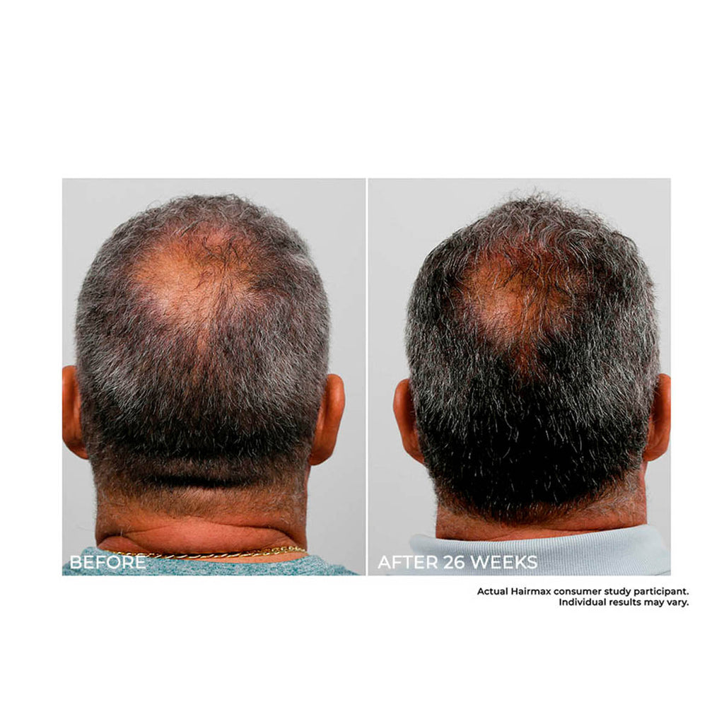 Cordless Hair Growth Comb